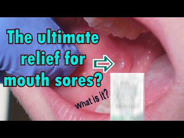 The best relief for mouth sores and ulcers?