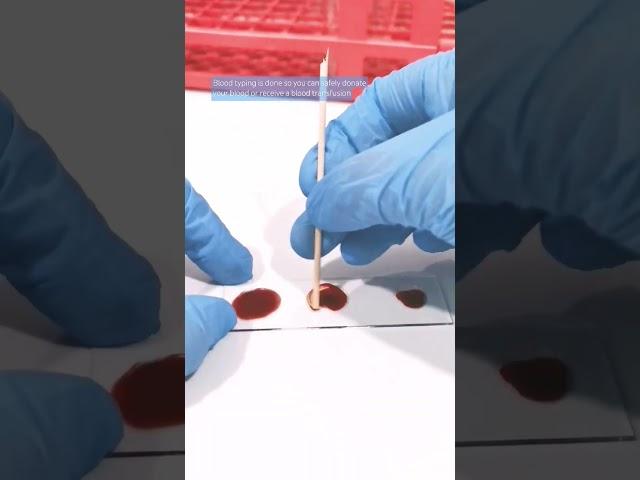Blood typing procedure #mls #cls #medtechstudent #blood #laboratory