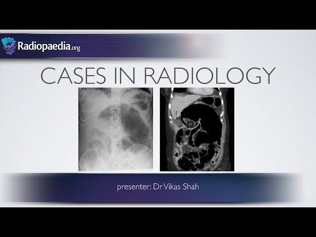 Cases in Radiology: Episode 6 (abdominal emergency, x-ray, CT)