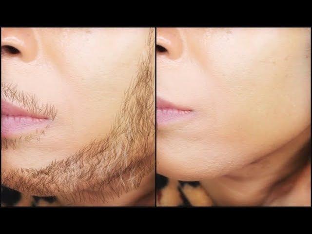 The shocking secret to removing facial hair permanently | Khichi Beauty