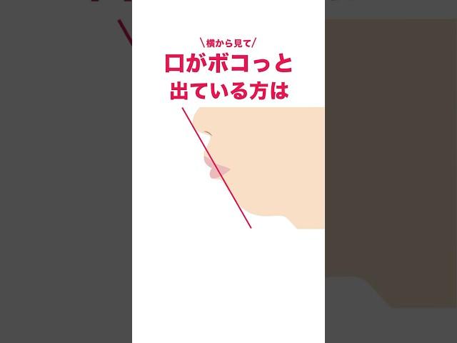 ワイヤーではなくマウスピース矯正で治したい方必見 #shorts #歯列矯正 #マウスピース矯正 #インビザライン