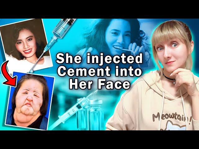 CEMENT injection in face | What are Asian women ready for beauty? | Dangerous beauty trends in Japan