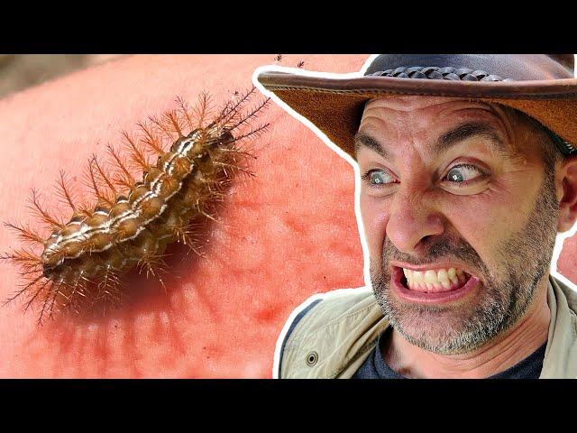 STUNG by the GIANT Silk Caterpillar!