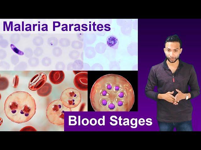 How to Identify & differentiate malaria parasites | Thin blood smear examination