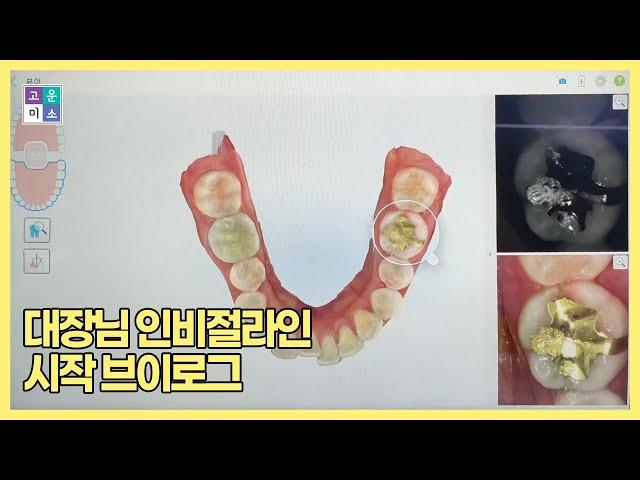 교정과｜대장님 인비절라인 시작한다!