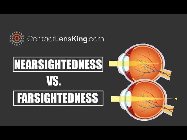 Nearsightedness Vs Farsightedness and the Difference Between the Two