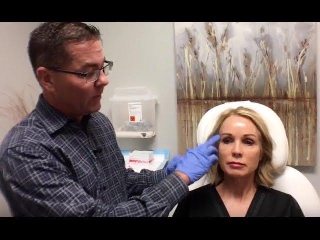 Botox & Dysport Injections - Dr Brent Larsen