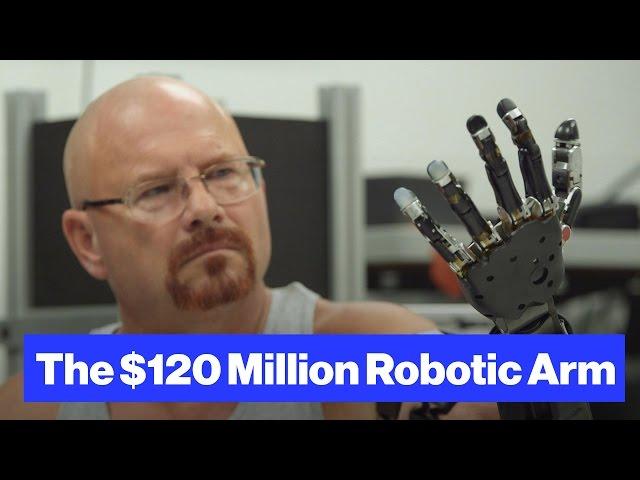 The Robot-Arm Prosthetic Controlled by Thought