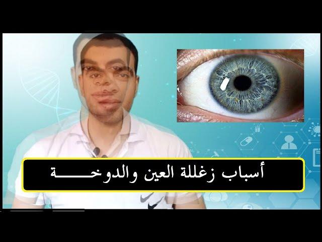 اسباب زغللة العين والدوخة ضياء تيوب   Diyaa Tube