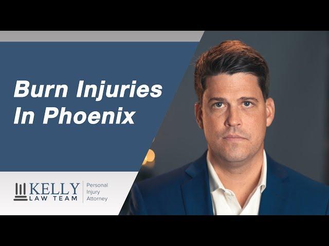 Phoenix Burn Injury Lawyer - Kelly Law Team