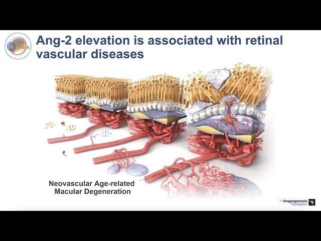 3. The ANG/TIE System - Role in Vascular Stabilization and Pathology