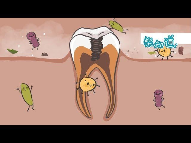 与300多种口腔细菌共处，如何保护牙齿？How to Prevent Dental Cavities?丨科普丨冷知识丨柴知道ChaiKnows