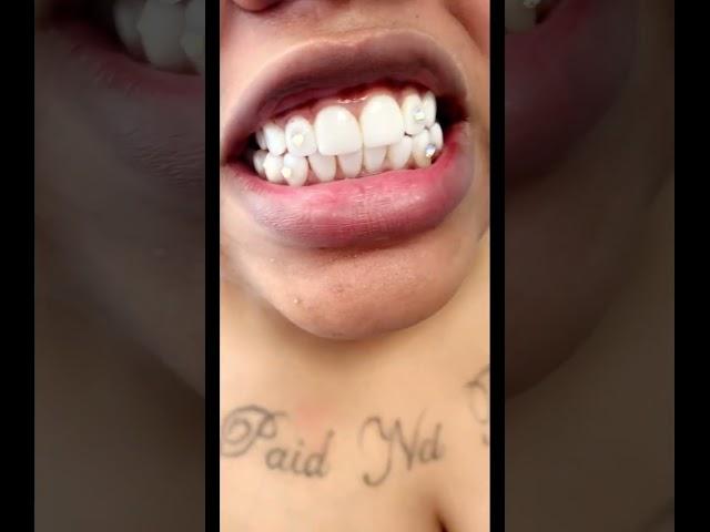 Unlock your radiant smile with our stunning tooth gems