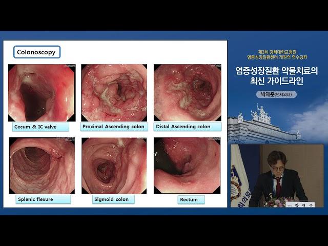 염증성장질환 약물치료의 최신 가이드라인 - 강남세브란스병원 소화기내과 박재준 교수