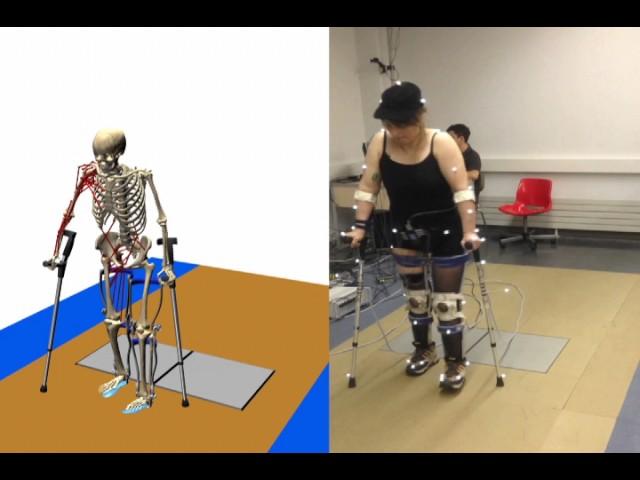 Personalized Musculoskeletal Model