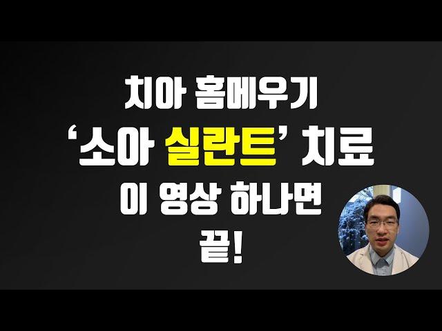 치아 홈메우기 소아 실란트 치료란 무엇일까?