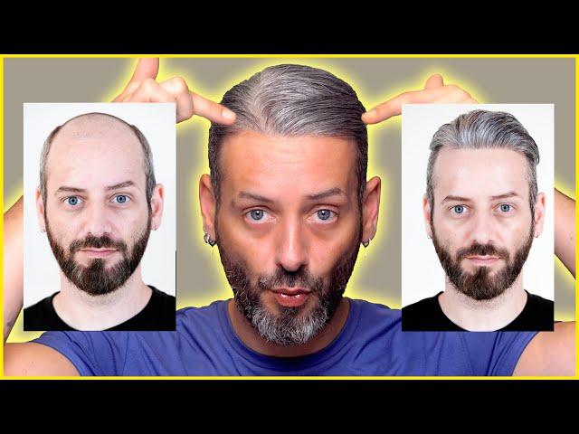 IF YOU ARE BALD YOU NEED TO TRY THIS! LIFEHACK: HAIR REPLACEMENT SYSTEM