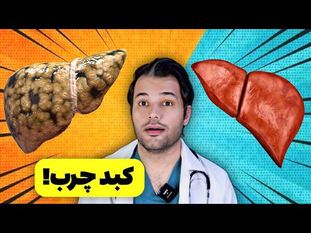 10 علامت کبد چرب که لازمه حتما بدونید |  درمان کبد چرب