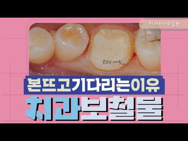 크라운/인레이 본뜨고 몇일 기다렸다 완성된 보철물을 결합하는 이유