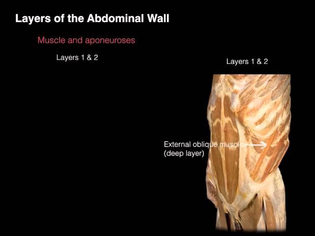 Ant Abdominal Wall Anterior view