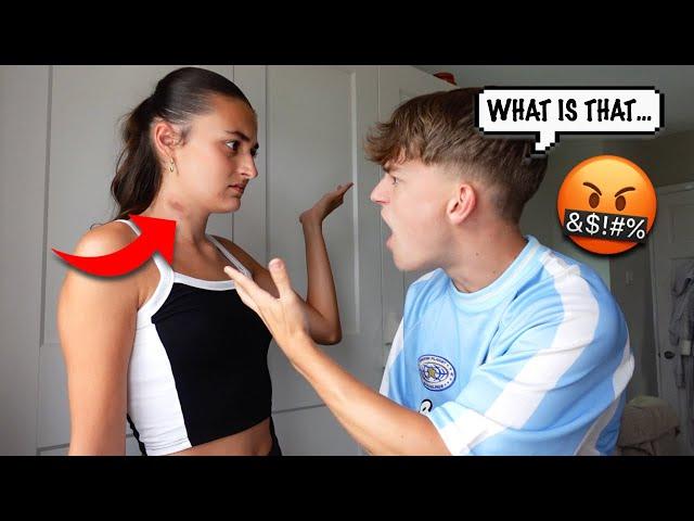 Hiding HICKEYS From My BOYFRIEND Prank *HE WAS PISSED*