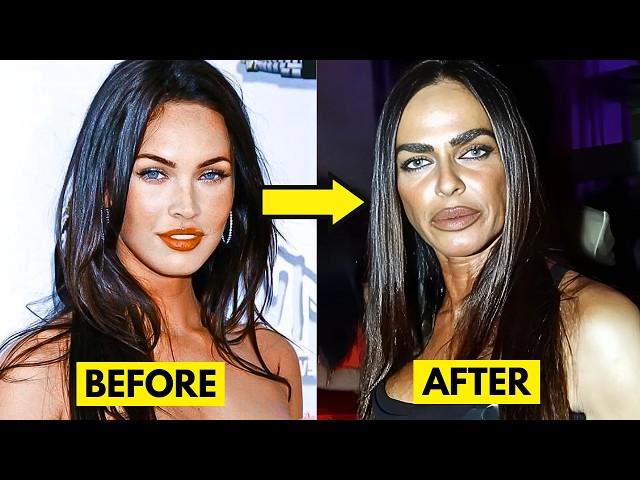 20 People Who Had Extreme Plastic Surgery