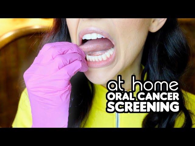 How To Screen For Oral Cancer At Home