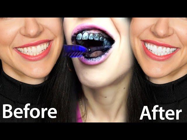 Fastest Way To Whiten Teeth At Home (What REALLY Works)