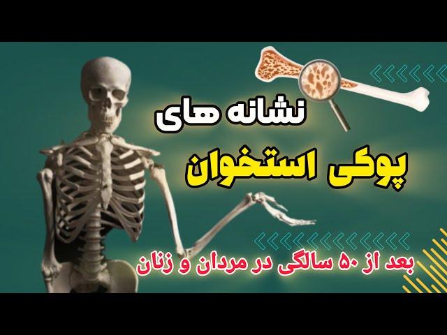 رازهایی که شما را از پوکی استخوان نجات میده ! | چه کسانی بیشتر به پوکی استخوان دچار می‌شوند