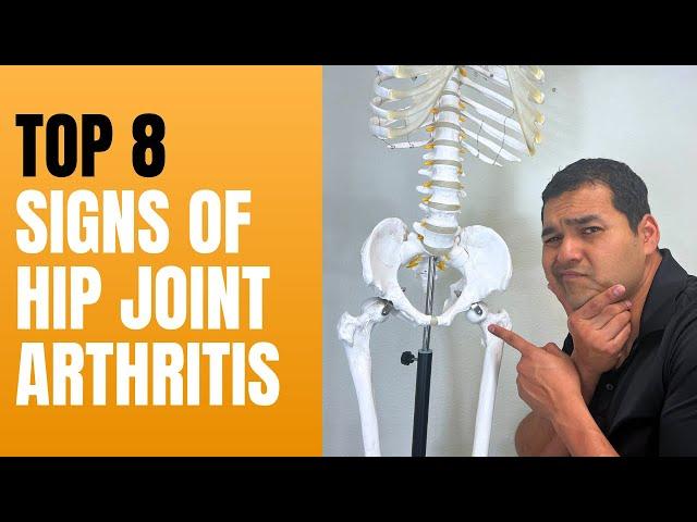 Top 8 Hip Joint Arthritis Symptoms & Signs