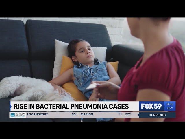 Health experts warning of a rise in bacterial pneumonia cases, symptoms to look for