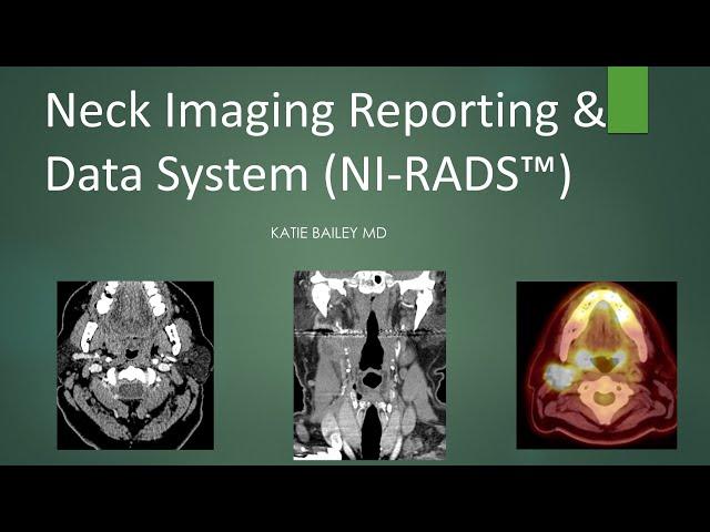 Neck Imaging Reporting and Data System (NI-RADS) Introduction