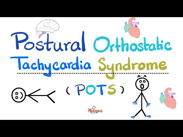 Postural Orthostatic Tachycardia Syndrome (POTS) - Causes, Symptoms, Diagnosis, Treatment-Cardiology