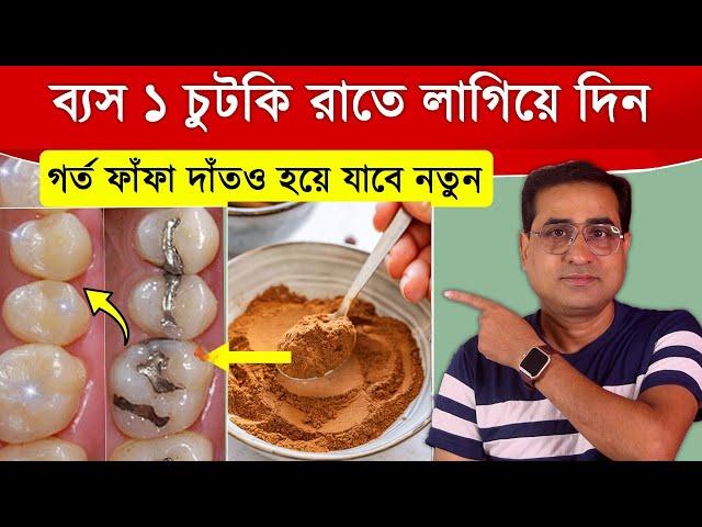দাঁতের যেকোনো সমস্যার সমাধান | গর্ত হওয়া, ফাঁফা, পোকা লাগা ও হলুদ দাঁত থেকে মুক্তি পান