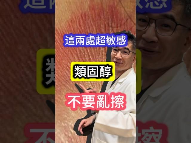 這兩處超 #敏感#皮膚科醫生 說#類固醇 不要亂擦#吳仁欽皮膚科診所 #屏東醫美 #眼周 #陰囊 #過敏 #陰囊搔癢症 #類固醇 #免疫調節劑 #眼周細紋 #魚尾紋 #皺眉紋 #抬頭紋