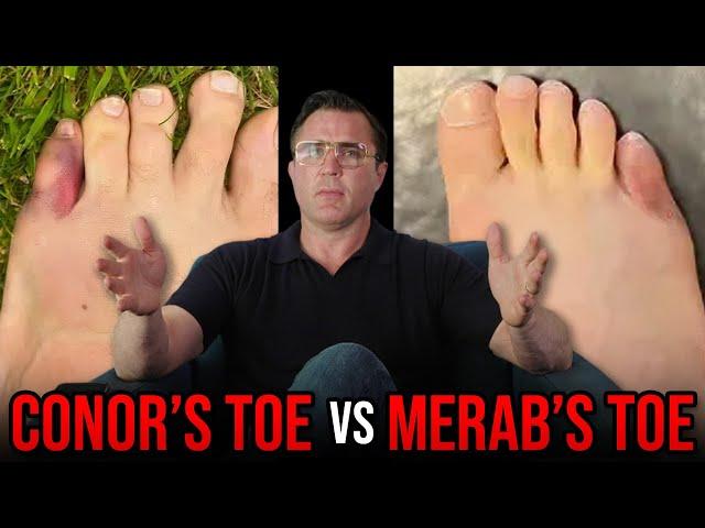 Merab’s Toe vs Conor’s Toe…