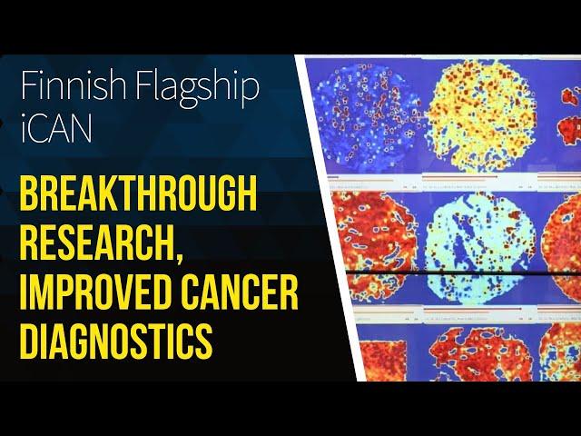 Finnish Flagship: Digital Precision Cancer Medicine Platform iCAN