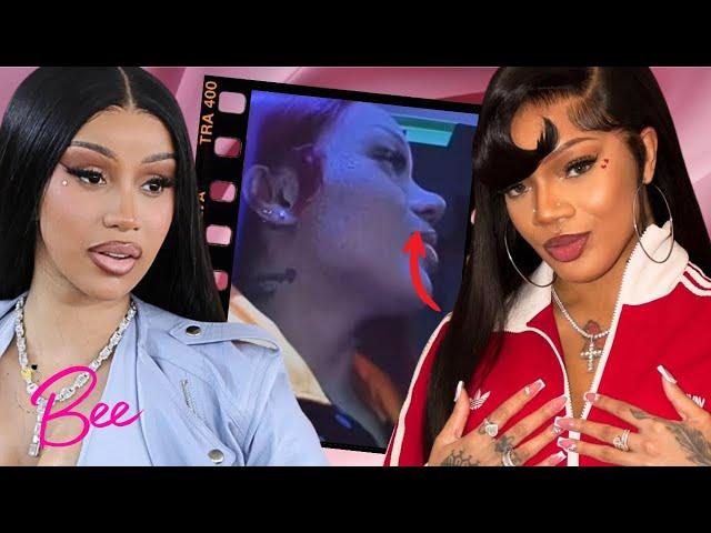 Cardi B DEFENDS GloRilla After Her Nose Job Gets Her DRAGGED & Sparks Negative Backlash