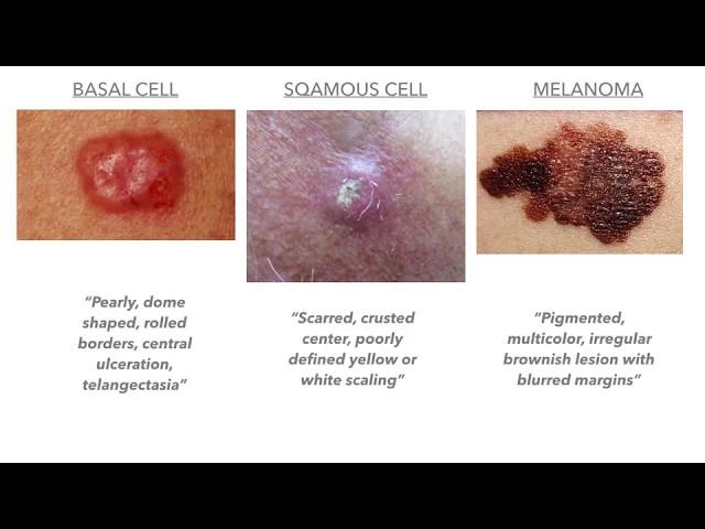 Dermatology on USMLE/COMLEX