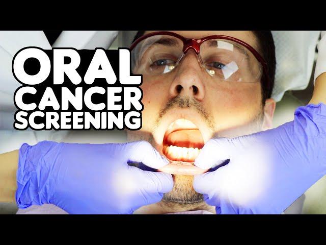 How Oral Cancer Screenings Are Performed