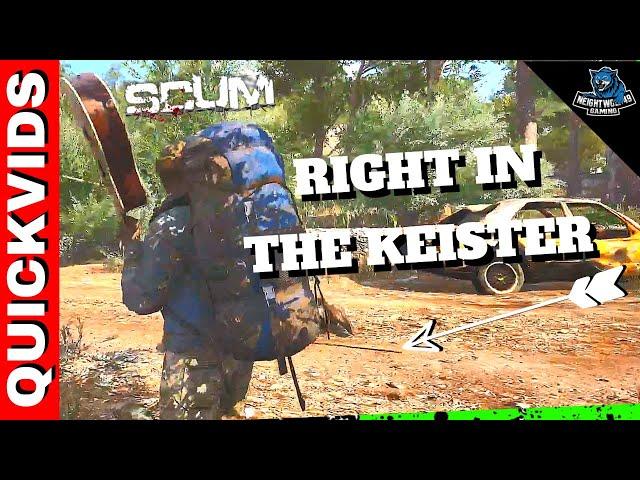 SCUM Funny Moments: Right in the Keister [Hilarious Gameplay]