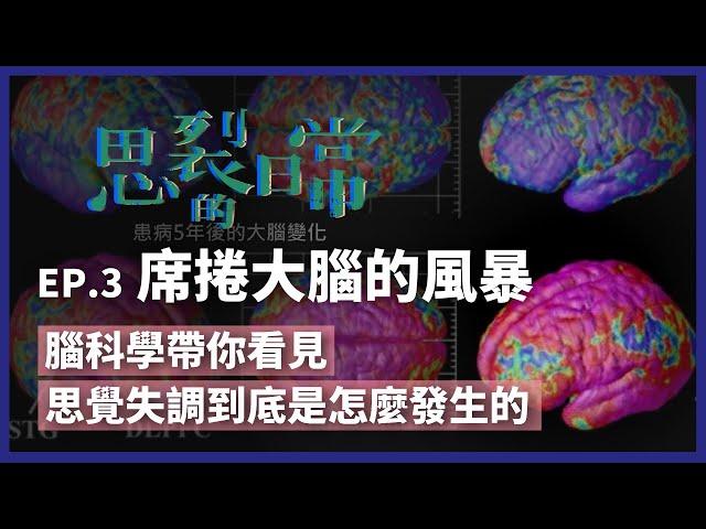 思裂的日常》大腦生病了！腦科學解密 思覺失調怎麼發生的？（公共電視 - 有話好說）
