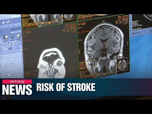 Korean researchers reveal how cigarette smoke, cadmium exposure increase risk of stroke