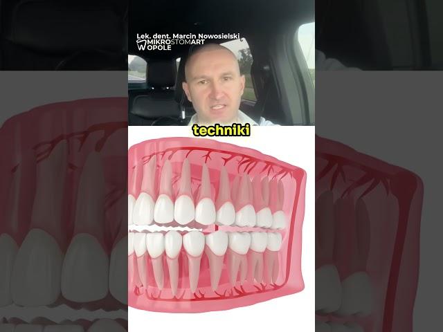 Czy Usuwanie Ósemek Boli  (Animacja 3D Dentystyczna)