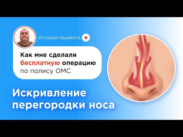 Как я сделал операцию бесплатно по ОМС — септопластика при искривлении перегородки носа