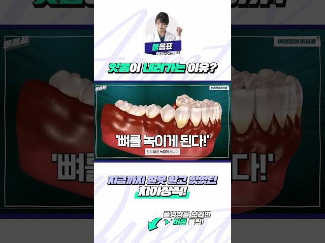 잇몸이 내려가는 이유? #잇몸퇴축 #잇몸질환 #잇몸병 #잇몸치료 #잇몸 #잇몸내려앉음 #잇몸이내려가는이유 #치주질환 #치주염 #치아상식 #치과상식 #치과치료 #이현정의물음표