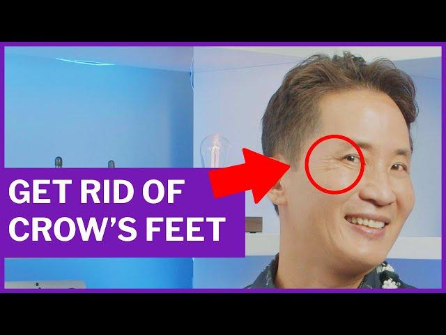 GET RID OF CROW'S FEET | Dr. David Yew