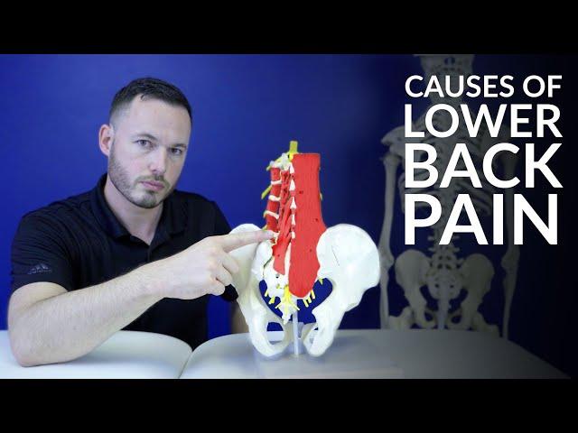 Low back pain- The most common causes of lower back pain