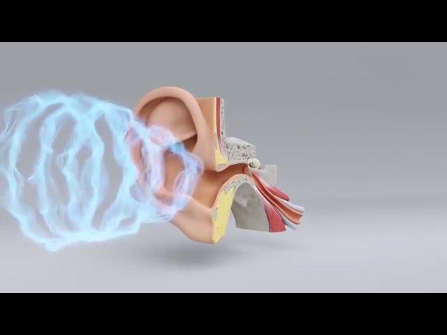 Explore the Science of Hearing Loss | Miracle-Ear Hearing Center