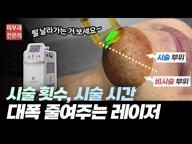 남자 제모 1등! 젠틀맥스 프로 플러스 | 수염 가슴 다리 등 부위별 제모 영상 공개